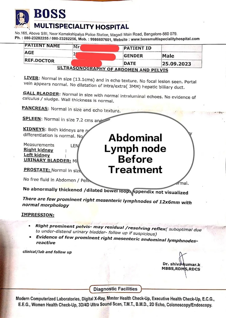Abdominal Lymph Node Before